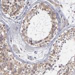 TMX Antibody in Immunohistochemistry (Paraffin) (IHC (P))