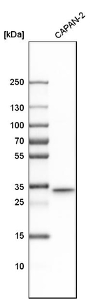 TMX Antibody in Western Blot (WB)