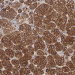 RAB9 Antibody in Immunohistochemistry (Paraffin) (IHC (P))