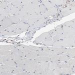 RAB9 Antibody in Immunohistochemistry (Paraffin) (IHC (P))