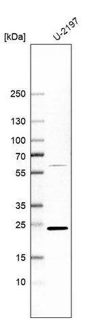 RAB9 Antibody in Western Blot (WB)