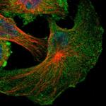 NF2 Polyclonal Antibody