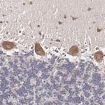 NF2 Antibody in Immunohistochemistry (Paraffin) (IHC (P))