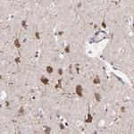 NF2 Antibody in Immunohistochemistry (Paraffin) (IHC (P))