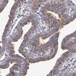 NF2 Antibody in Immunohistochemistry (Paraffin) (IHC (P))