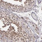 NF2 Antibody in Immunohistochemistry (Paraffin) (IHC (P))