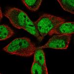 USP11 Polyclonal Antibody