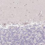 USP11 Antibody in Immunohistochemistry (Paraffin) (IHC (P))