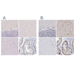 USP11 Antibody in Immunohistochemistry (Paraffin) (IHC (P))