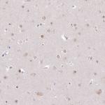 USP11 Antibody in Immunohistochemistry (Paraffin) (IHC (P))