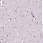 USP11 Antibody in Immunohistochemistry (Paraffin) (IHC (P))