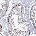 USP11 Antibody in Immunohistochemistry (Paraffin) (IHC (P))