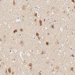 SULT4A1 Antibody in Immunohistochemistry (Paraffin) (IHC (P))