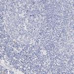 SULT4A1 Polyclonal Antibody