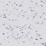 Zap-70 Polyclonal Antibody