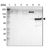 Zap-70 Antibody in Western Blot (WB)