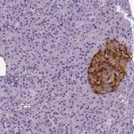 TSPAN7 Polyclonal Antibody