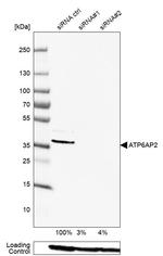 ATP6IP2 Antibody