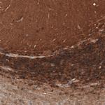 ATP6IP2 Antibody in Immunohistochemistry (Paraffin) (IHC (P))