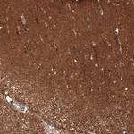 ATP6IP2 Polyclonal Antibody