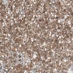 ATP6IP2 Antibody in Immunohistochemistry (Paraffin) (IHC (P))