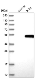 Biglycan Antibody in Western Blot (WB)