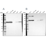 TCP-1 beta Antibody in Western Blot (WB)