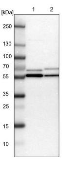 TCP-1 beta Antibody in Western Blot (WB)
