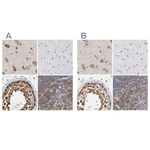 TCP-1 beta Antibody in Immunohistochemistry (Paraffin) (IHC (P))