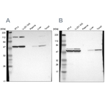 TCP-1 beta Antibody in Western Blot (WB)
