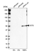 TCP-1 beta Antibody in Western Blot (WB)