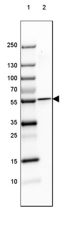 TCP-1 beta Antibody in Western Blot (WB)