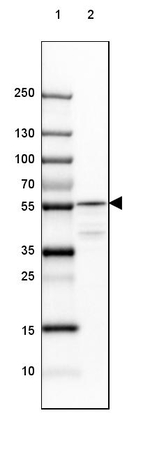TCP-1 beta Antibody in Western Blot (WB)