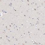CD268 (BAFF Receptor) Antibody in Immunohistochemistry (Paraffin) (IHC (P))