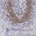 CD268 (BAFF Receptor) Antibody in Immunohistochemistry (Paraffin) (IHC (P))