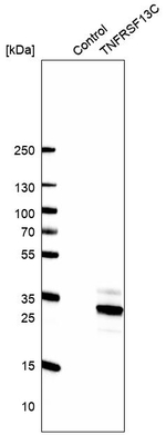 CD268 (BAFF Receptor) Antibody in Western Blot (WB)