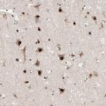 MEIS2 Antibody in Immunohistochemistry (Paraffin) (IHC (P))