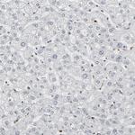 MEIS2 Antibody in Immunohistochemistry (Paraffin) (IHC (P))