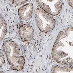 MEIS2 Antibody in Immunohistochemistry (Paraffin) (IHC (P))