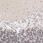 GABPA Antibody in Immunohistochemistry (Paraffin) (IHC (P))