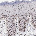 GABPA Antibody in Immunohistochemistry (Paraffin) (IHC (P))
