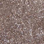 GABPA Antibody in Immunohistochemistry (Paraffin) (IHC (P))