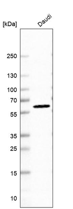 GABPA Antibody in Western Blot (WB)