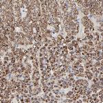 TrxR2 Antibody in Immunohistochemistry (Paraffin) (IHC (P))