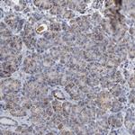 TrxR2 Antibody in Immunohistochemistry (Paraffin) (IHC (P))