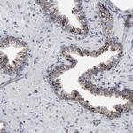 TrxR2 Antibody in Immunohistochemistry (Paraffin) (IHC (P))