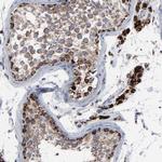 TrxR2 Polyclonal Antibody