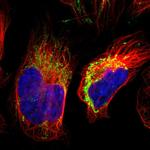 S100A10 Polyclonal Antibody