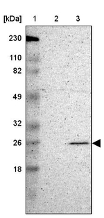 MAD2 Antibody in Western Blot (WB)