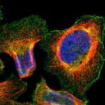 SLC16A2 Polyclonal Antibody